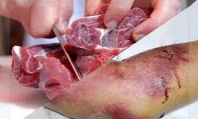 بهبودی کامل 3نفر مبتلا به بیماری تب خونریزی دهنده کنگو در استان کرمانشاه