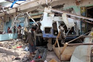وزیر بهداشت نسبت به وقوع فاجعه انسانی در یمن هشدار داد