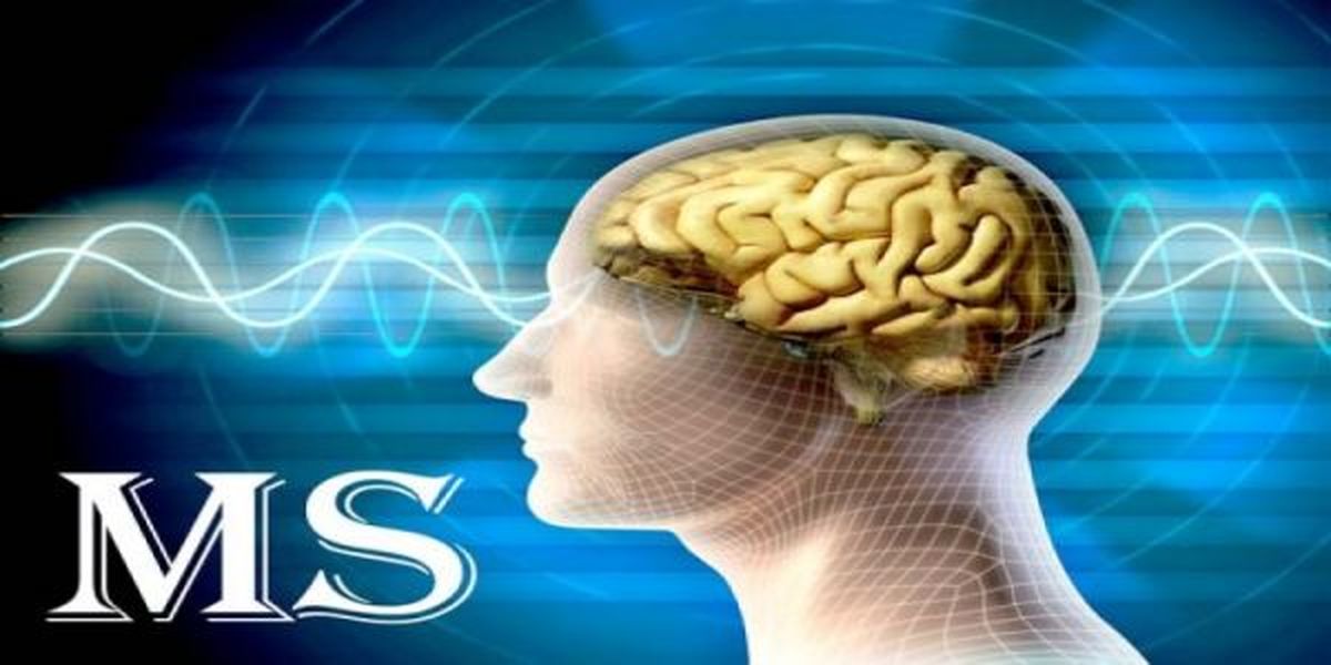 بودجه فعلی بیماریهای خاص، پاسخگوی هزینههای بیماران مبتلا به ام اس نیست