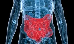 توصیه مهم برای پیشگیری از سرطان روده بزرگ