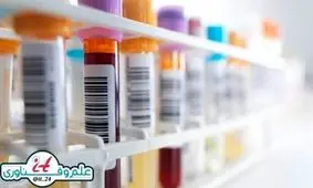 ابداع آزمايش جديد تشخيص سرطان