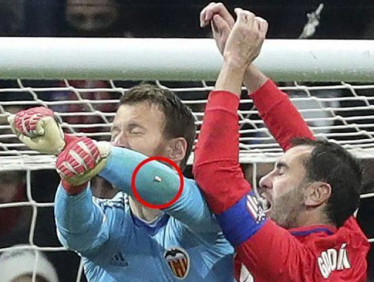 جا ماندن دندان مدافع روی بازوی دروازه بان! +عکس