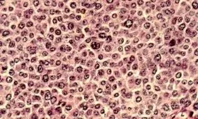 ابداع یک متد جدید برای بررسی سلولهای سرطانی