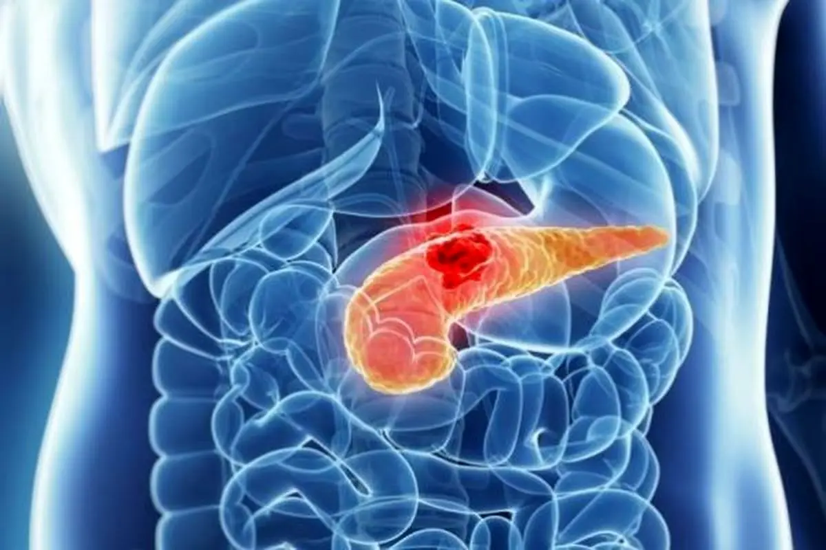 نشانه‌های سرطان کبد