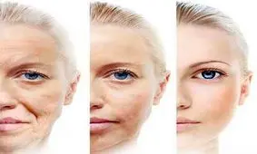 راهکارهایی برای جوان‌تر شدن