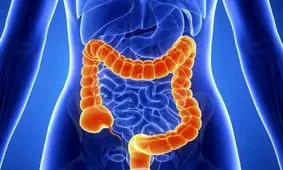 بخور و نخورها برای مبتلایان به "سندرم روده تحریک پذیر"