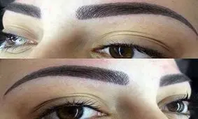 اگر می‌خواهید خالکوبی روی بدنتان را پاک کنید، ببینید/ تفاوت میکروپیگمنتیشن و تتو چیست؟