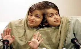 سفر در زمان؛ «لاله و لادن، دوقلوهای به هم چسبیده» در کودکی؛ دهه 50 