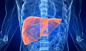 نکات تغذیه ای برای مبتلایان به "سیروز کبد"