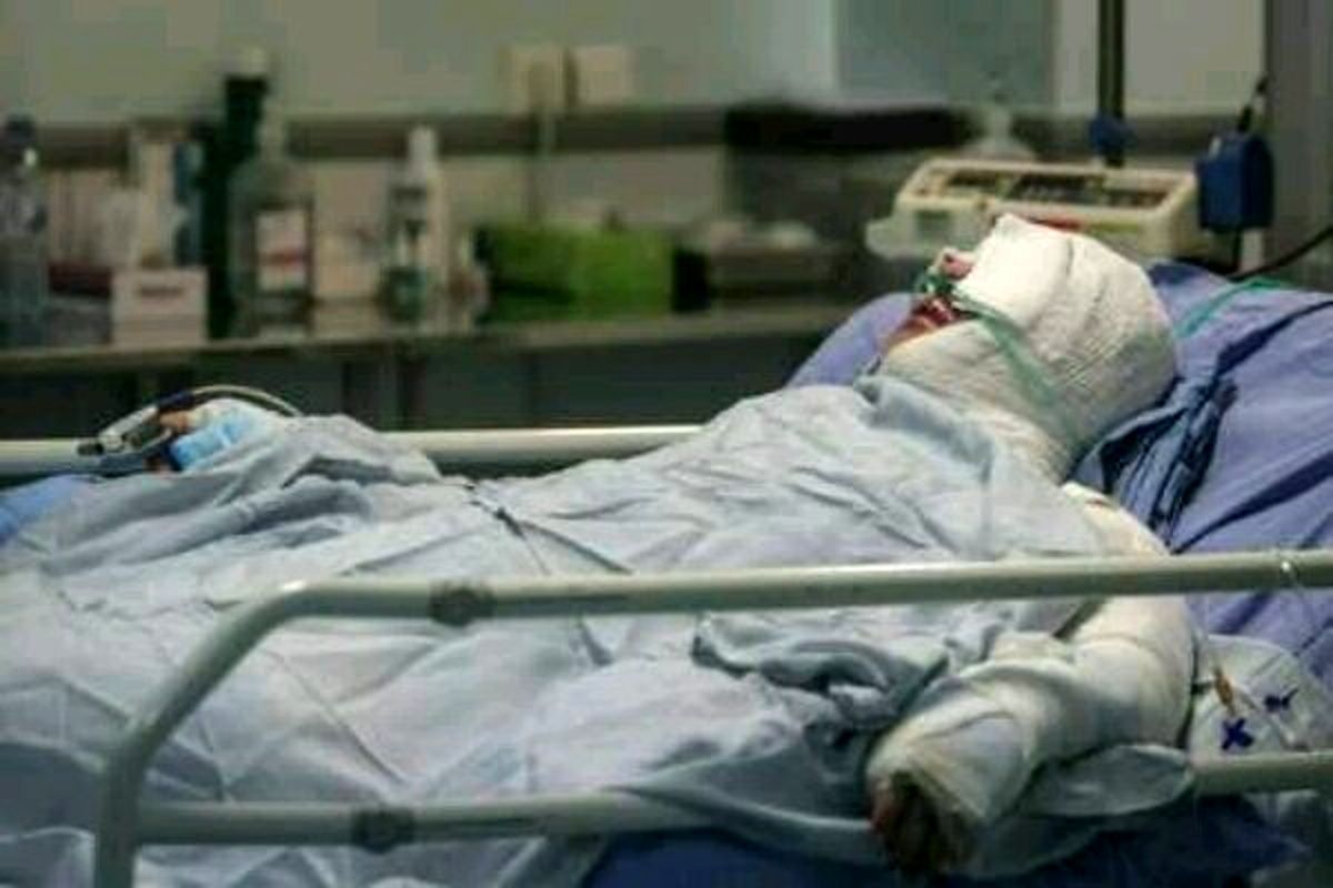 تبعات سوختگی های شدید حوادث چهارشنبه سوری