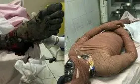 فوت ۳ نفر در حوادث چهارشنبه آخر سال/ مصدومیت ۳۸۵ نفر