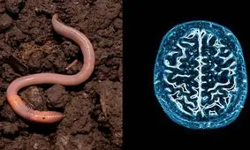 خارج کردن کرم ۱۸ سانتی‌متری از مغز یک مرد