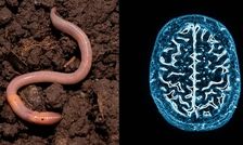 خارج کردن کرم ۱۸ سانتی‌متری از مغز یک مرد