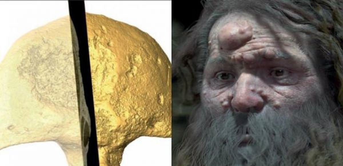 بازسازی چهرۀ انسان کرومانیون؛ دلیل وجود حفره در جمجمه کشف شد
