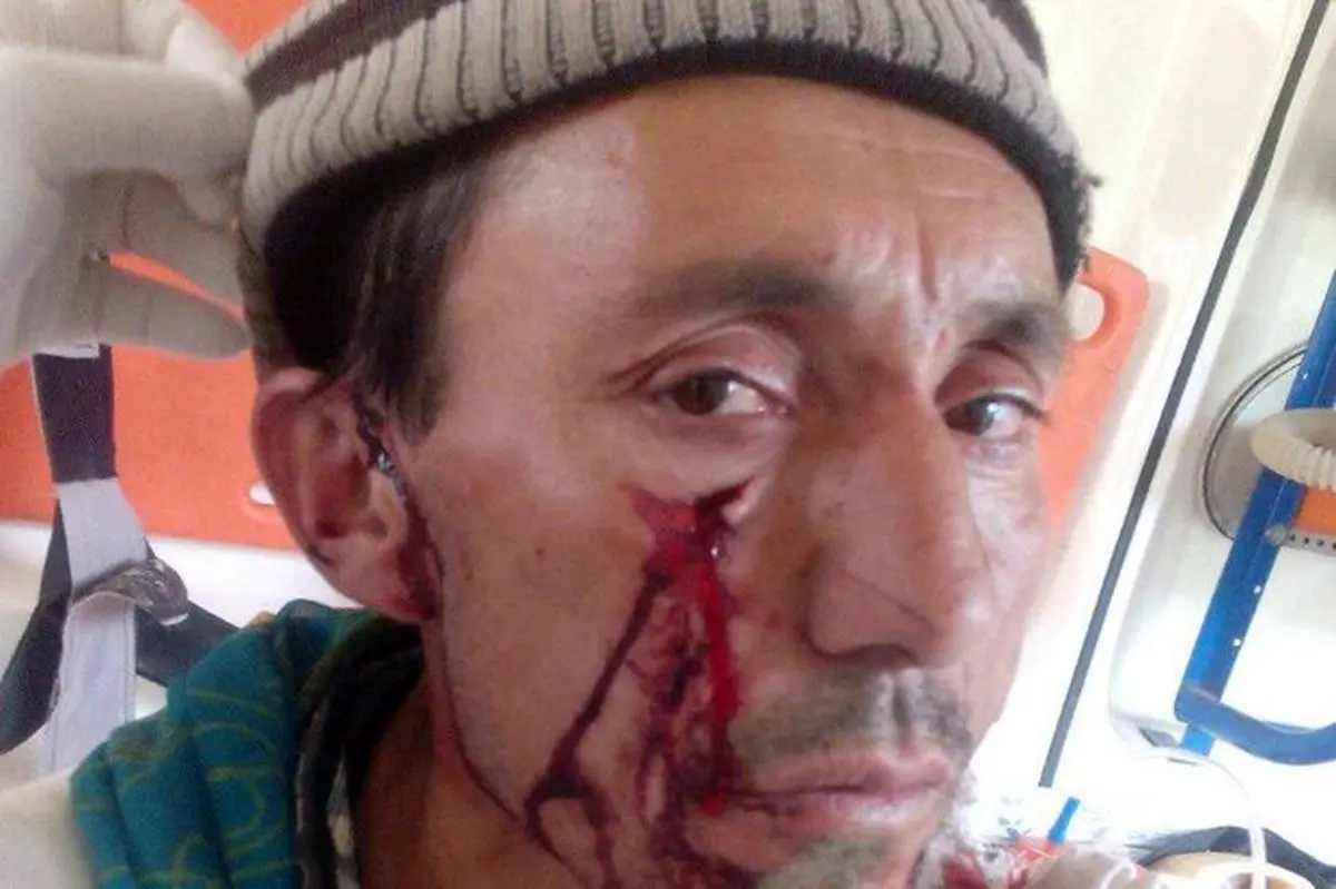 حمله پلنگ به چوپان کلاله‌ای + عکس