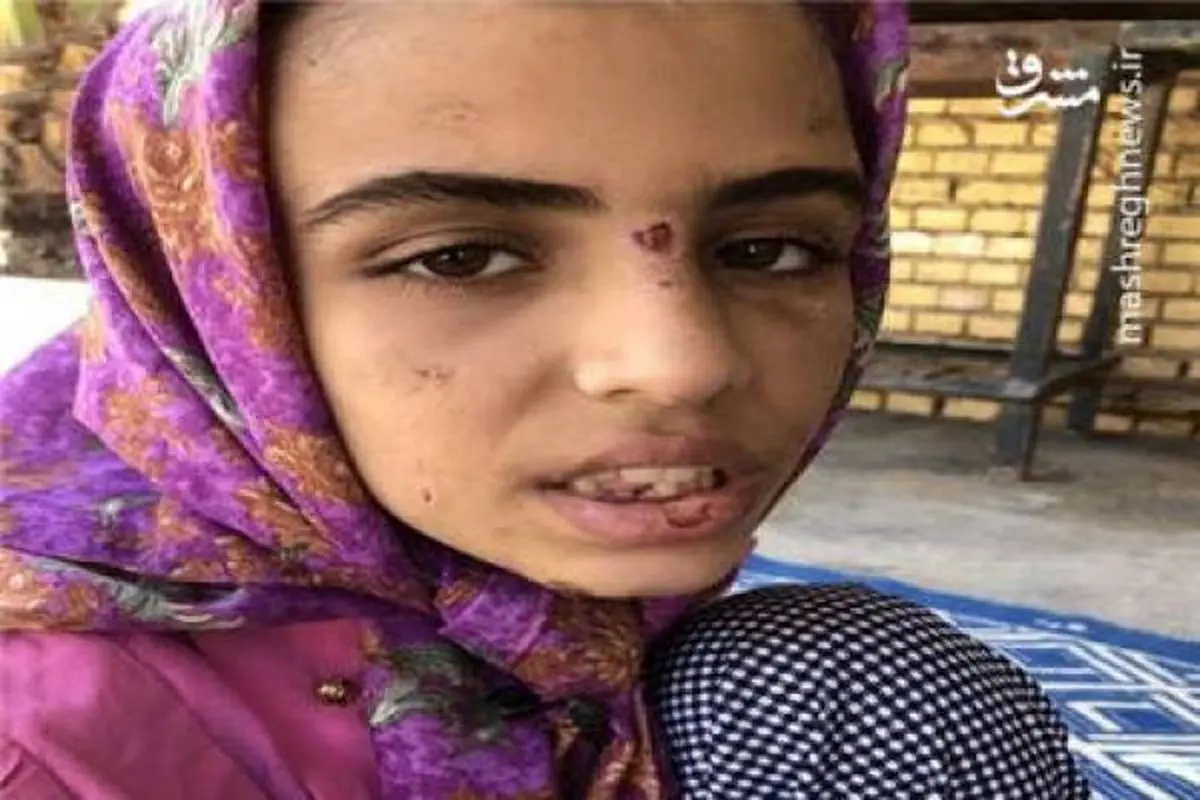 صحبت‌های وحشت آور فاطمه کودک ماهشهری؛ نامادری‌ام با چسب حرارتی دهنم رو بسته بود