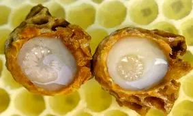 با خواص درمانی ژل رویال آشنا شوید