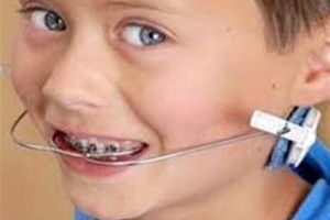 3 علت ناهنجاری‌ دندان کودکان