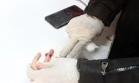 دست زن جوان در دستگاه دگمه‌زنی قفل شد+ تصاویر