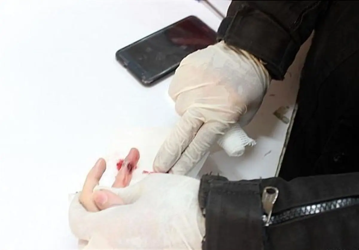 دست زن جوان در دستگاه دگمه‌زنی قفل شد+ تصاویر