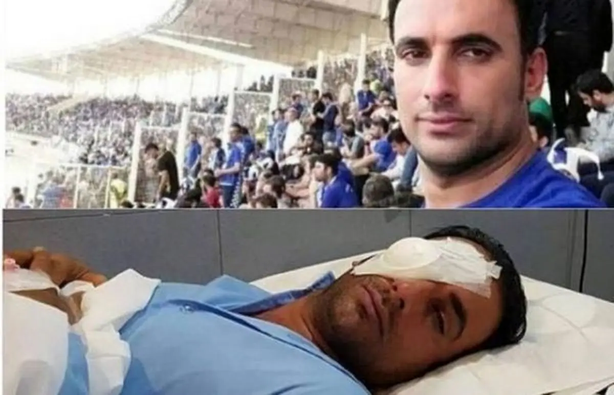 آخرین وضعیت هوادار مضروب استقلال در فینال جام حذفی