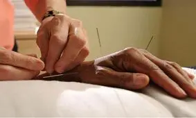 درمان ترس از دندانپزشکی با شیوه طب سوزنی