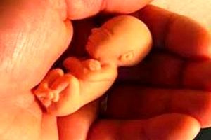 وضعیت سقط جنین در ایران + قوانین