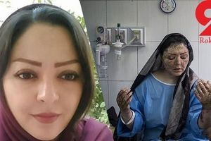 عکس های دیده نشده از آخرین وضعیت درمانی مریم قربانی اسیدپاشی تبریز + جزئیات