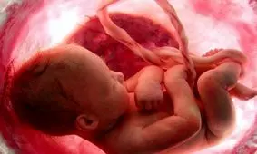 مادر واقعی "نوزاد متولد شده از رحم اجاره‌ای" نامشخص است