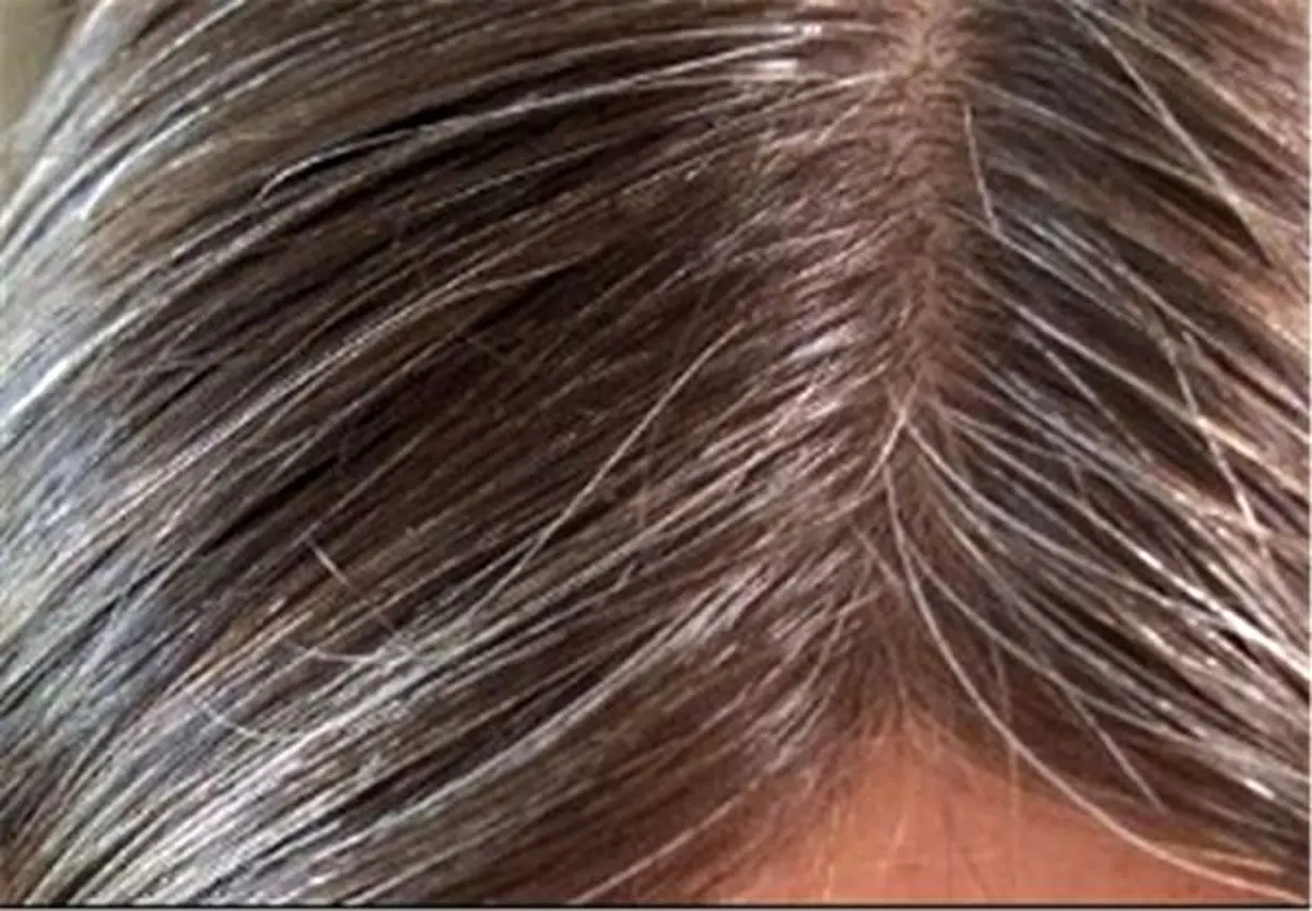 گیاهی شگفت انگیز که مانع سفیدشدن موهایتان می‌شود