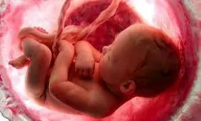 ۷ دلیل سقط جنین!