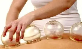 حجامت جایگزین اهدای خون نیست