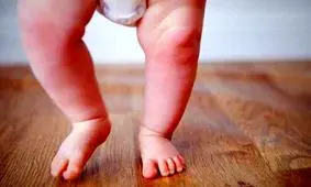 چرا کودکان دچار پای پرانتزی می شوند؟