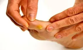 آنچه پا‌هایتان در مورد سلامتی و خطر قاتلان خاموش لو می‌دهد!

