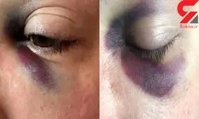 حمله مشکوک مرد غریبه به تازه عروس و داماد در خانه شان