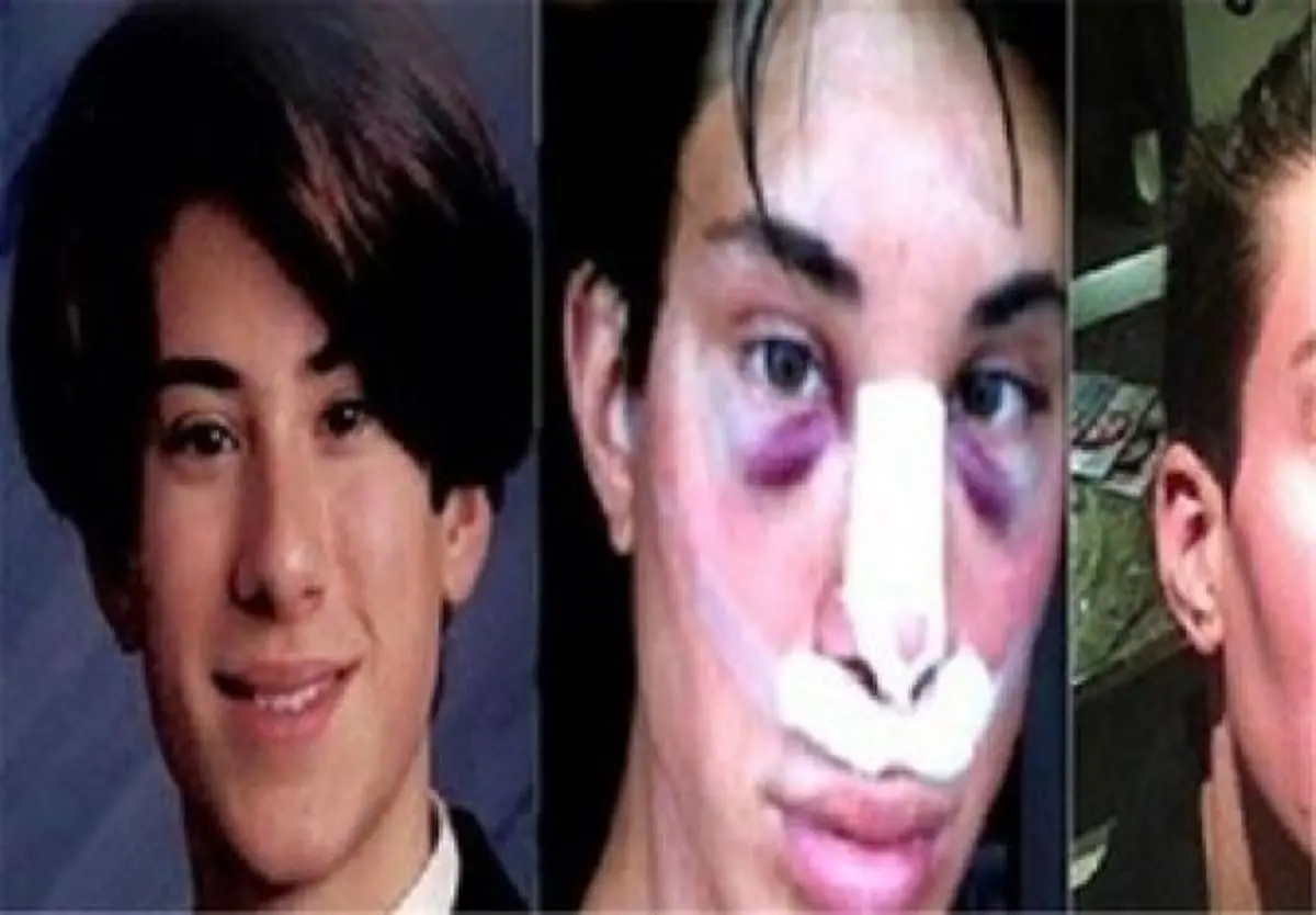 دلایل افزایش عمل زیبایی در بین مردان