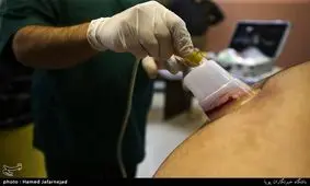 صفر تا صد سندیت تاکید بر انجام "حجامت حزیران" + پاسخ به شبهات