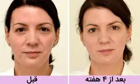 روایت زنی بریتانیای که با معجزه ی آب 10 سال جوانتر شد