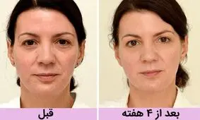 روایت زنی بریتانیای که با معجزه ی آب 10 سال جوانتر شد