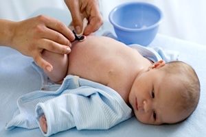 توصیه هایی درباره مراقبت از بند ناف نوزاد پس از تولد