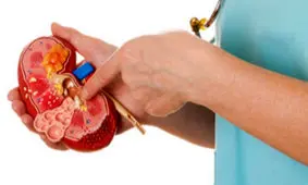 بلای جان کلیه ها را بشناسید