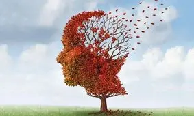 داروی ام اس؛ امیدی تازه برای درمان زوال عقل