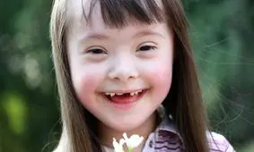 روز «سندروم داون» به تقویم بازگشت