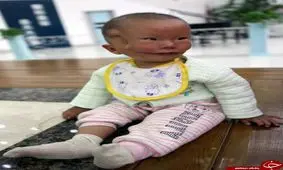 پسر بچه عجیبی که به کودک ماسک دار معروف شده است +تصاویر