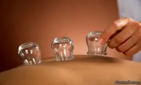 بادکش برای چه کسانی ممنوع است؟