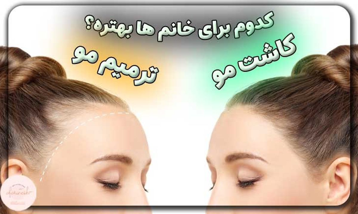 مقایسه کاشت مو و ترمیم مو؛ کدام برای خانمها بهتر است؟