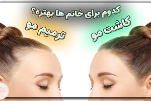 مقایسه کاشت مو و ترمیم مو؛ کدام برای خانم‌ها بهتر است؟
