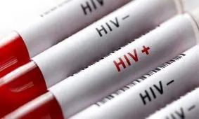 درمان موفق HIV در آستانه آزمایشات انسانی