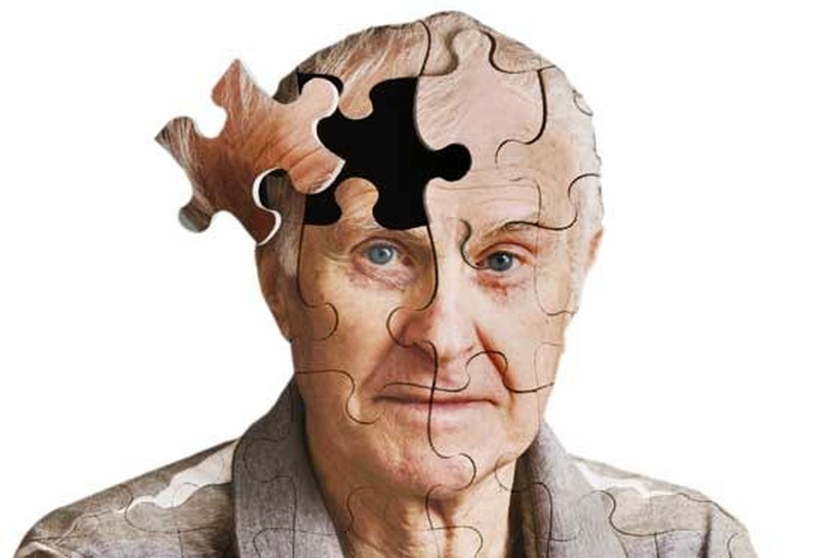 "بیگ‌بنگ" بیماری آلزایمر کشف شد