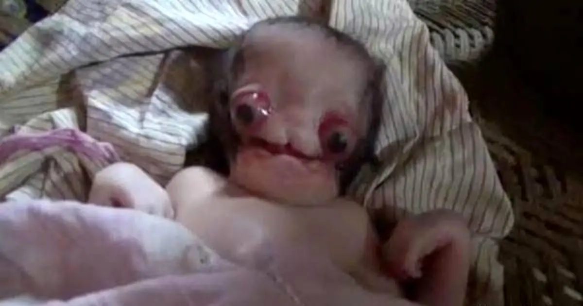 بدنیا آمدن ترسناک ترین نوزاد دنیا